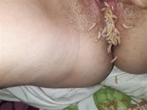 Maggots On Genitals Hot Sex Picture