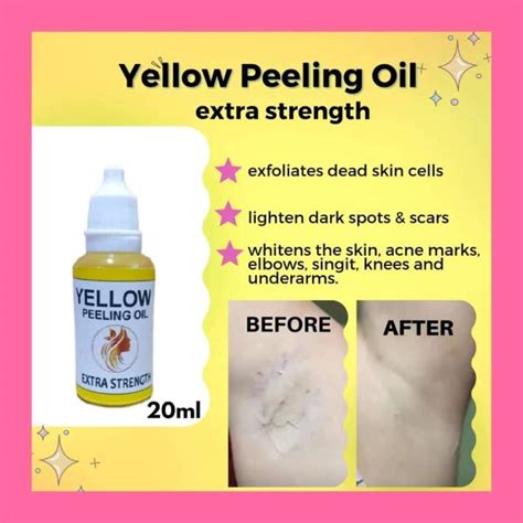 Yellow Peeling Oil Extra Strength 20ml Lazada Ph