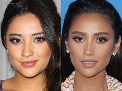 Shay Mitchell Before And After Face Fillers Shay Mitchell Hair Beauty