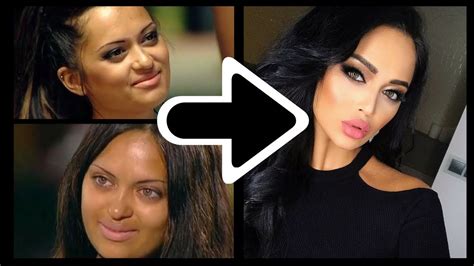 Social Media Influencers Before Surgeries Shocking Pictures Youtube