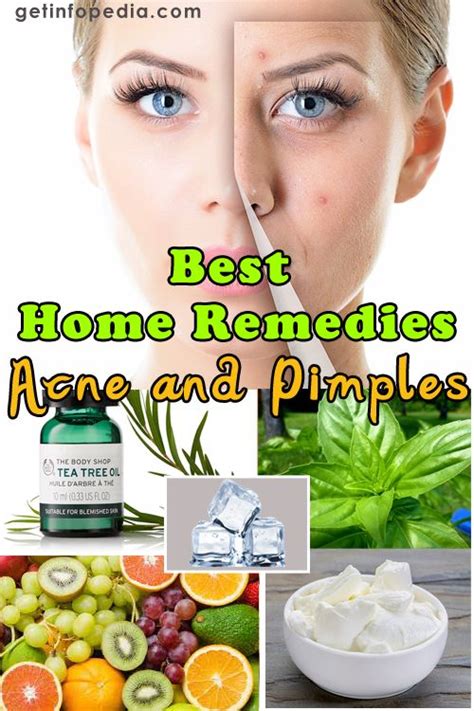 Tips To Get Rid Of Pimples How To Prevent Pimples