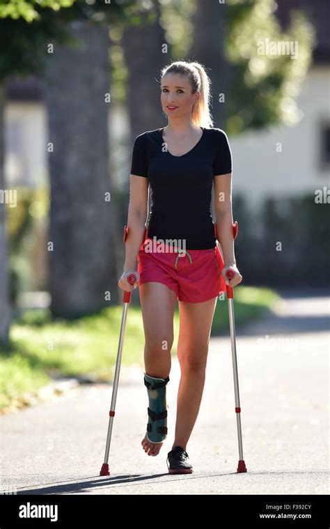 Young Woman With Crutches Walking With A Foot Injury With A Plaster