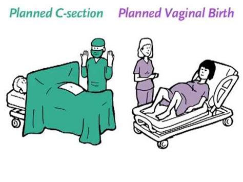 Cesarean Or Vaginal Delivery For Twins Nejm Youtube