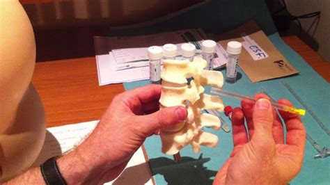 Lumbar Puncture Series 4 Lumbar Spine Anatomy And Needle