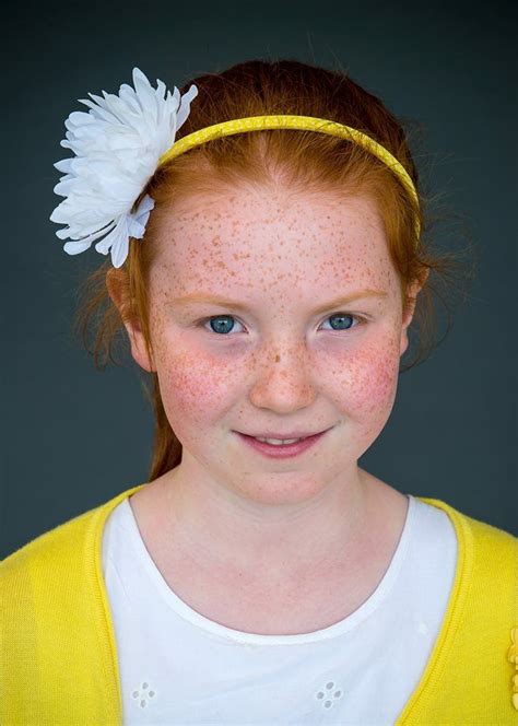 Pin By Ton Van De Merwe On Redheads Kids Freckles Redheads Redhead