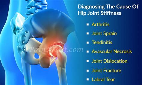Pin On Joint Pain Repair