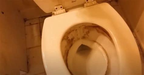 How To Get Rid Of Toilet Ring These Things Work