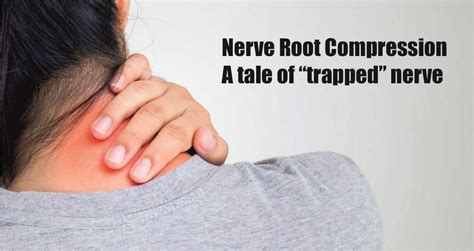 Nerve Root Compression The Trapped Nerve Ayurvedic Way To Treat