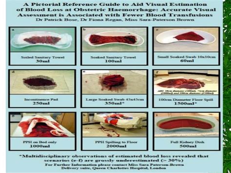 Medical Management Of Post Partum Haemorrhage