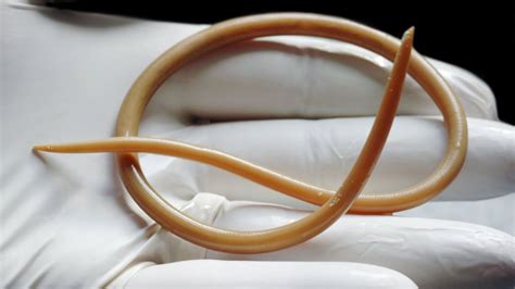 Parasitic Worm Increases Womens Fertility Bbc News