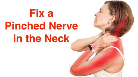 Fix A Pinched Nerve In The Neck With Free Exercise Sheet Youtube