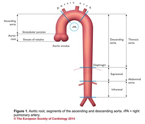 Valvular Emergencies Part 2 Diagnosis And Management Of Severe Aortic