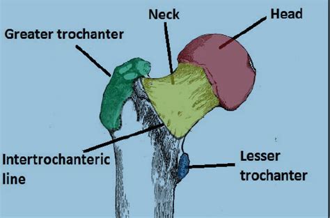 Hip Fractures Intertrochanteric Subtrochanteric And Femoral Neck