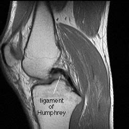 MRI Anatomy Knee WikiRadiography