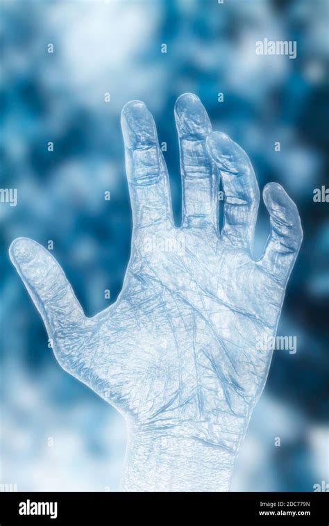 Frozen Man Hand Stock Photo Alamy