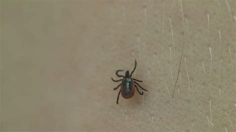 Ticks Are On The Rise In South Carolina