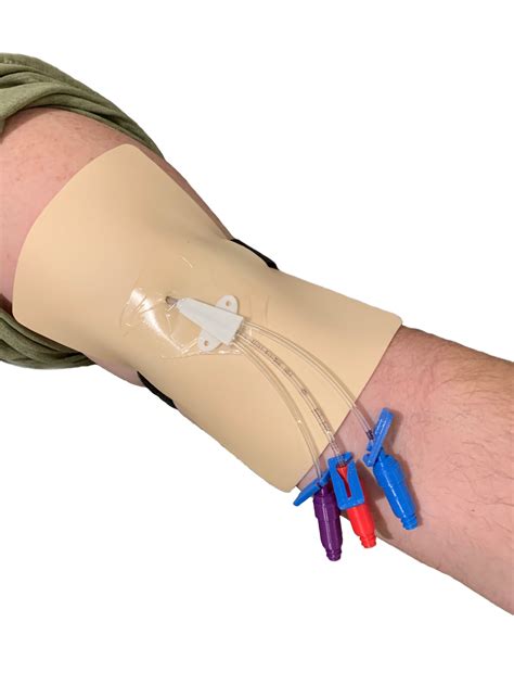 A dressing is worn over the area to prevent infection and keep the catheter in place. PICC line care practice set