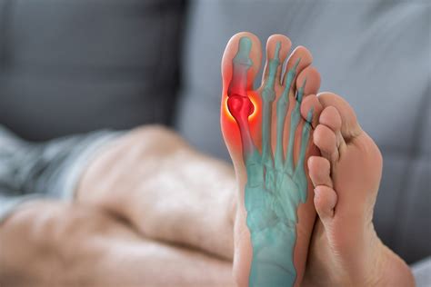 Sesamoid Foot Injury And Treatment The Foot Practice Singapore