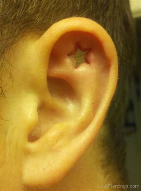 Star Dermal Punch Ear Piercing