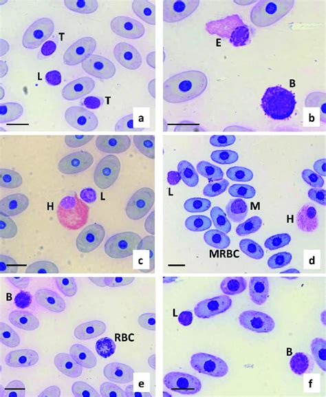 Modified Wright Giemsa Stained Peripheral Blood From A Galapagos