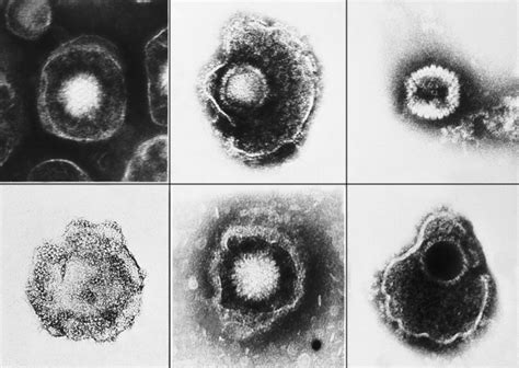 Electron Micrographs Of Herpes Viruses Biology Of Humanworld Of Viruses