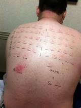 What Doctor Does Allergy Testing Pictures