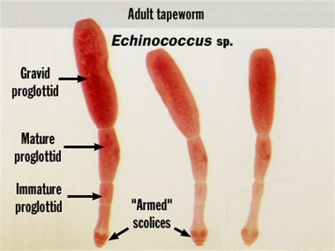 Medical Laboratory Technology Sop Echinococcus Granulosus