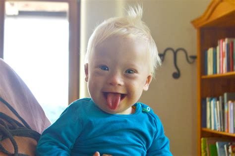 Down syndrome or down's syndrome, is a congenital condition that usually causes some degree of learning disability and is typically characterized by certain physical features. Downsyndrom: Eine Mama erzählt aus dem Alltag mit ihrem ...
