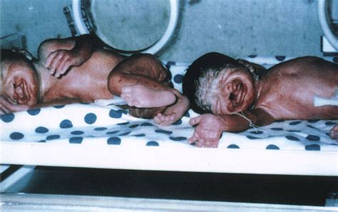 Uranium, enrichment, depleted uranium, military applications, du weapons, effectiveness, chemical and radiological toxicity, human health hazards: Depleted Uranium!