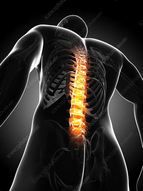 Back Pain Conceptual Artwork Stock Image F0068221 Science Photo