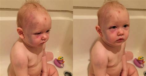 One Year Old Babe Gets Beaten Up By Babysitter Parents Recieve No Support From The Law