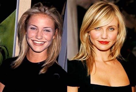 Cameron Diaz Before And After Plastic Surgery 05 Celebrity Plastic Surgery Online