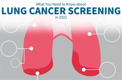 What You Need To Know About Lung Cancer Screening In 2022 Department