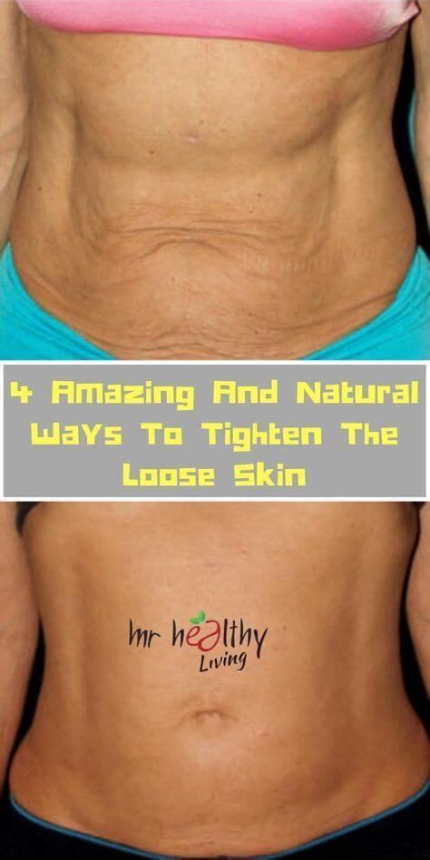 4 Natural Ways To Tighten The Loose Skin After Weight With Ease Skintighteningafterweightloss