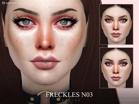 Sims 4 Cc Moles And Freckles