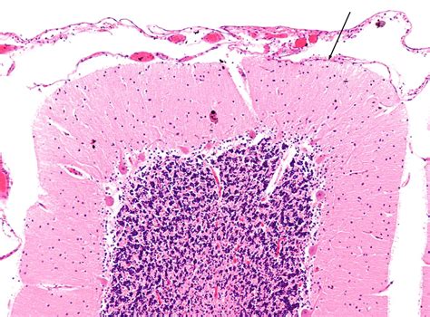 Cerebellum Layers Histology