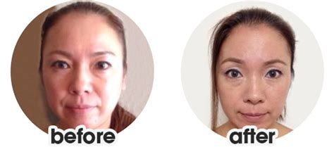 Face Yoga Before And Afters Face Yoga Method