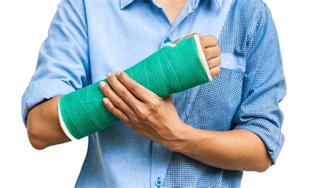Does a broken arm justify making a compensation claim? | Birchall ...