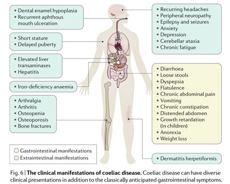 Celiac Disease Clinical Manifestations Gastrointestinal Grepmed