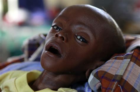 Pneumonia And Diarrhoea Responsible For 14 Million Child Deaths Each Year