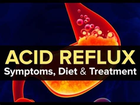 Try not to drinking drugs surgery is quick relief of mild symptoms how to cure gerd disappeared. How To Cure Acid Reflux (GERD) and Heartburn Fast and ...