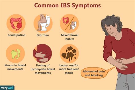 IBS-pijn begrijpen - Med NL