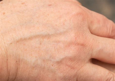 Veins On The Skin Of The Hands Stock Image Image Of Veins Flow