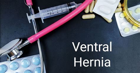 Causes Symptoms And Treatment Of Ventral Hernias Facty Health