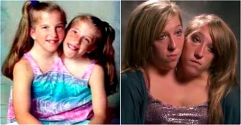 Here’s What Conjoined Twins Abby And Brittany Hensel Look Like Today Viraly