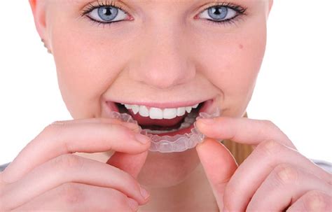 How Long Should You Wear Invisalign And Why Should You