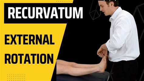 How To Do The External Rotation Recurvatum Test For The Knee Youtube