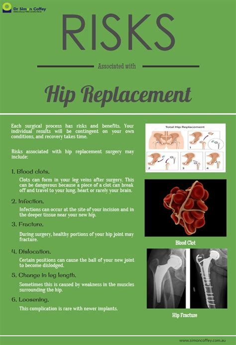 Patients with this condition typically feel a sudden sharp pain or pulling sensation in the front of the hip or groin at the time of injury. 25 best Total Hip Replacement | Surgery | Recovery images ...