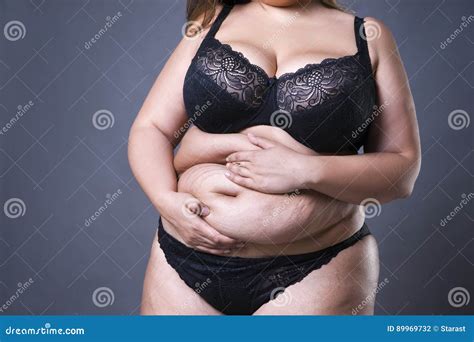 Woman With Fat Abdomen Overweight Female Stomach Stretch Marks On