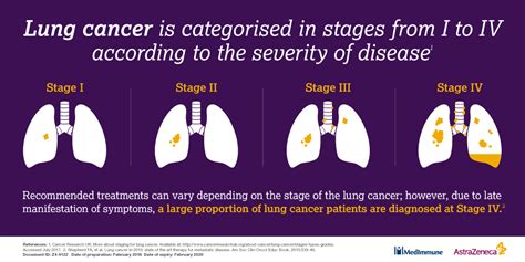 At The Forefront Of Lung Cancer Treatment